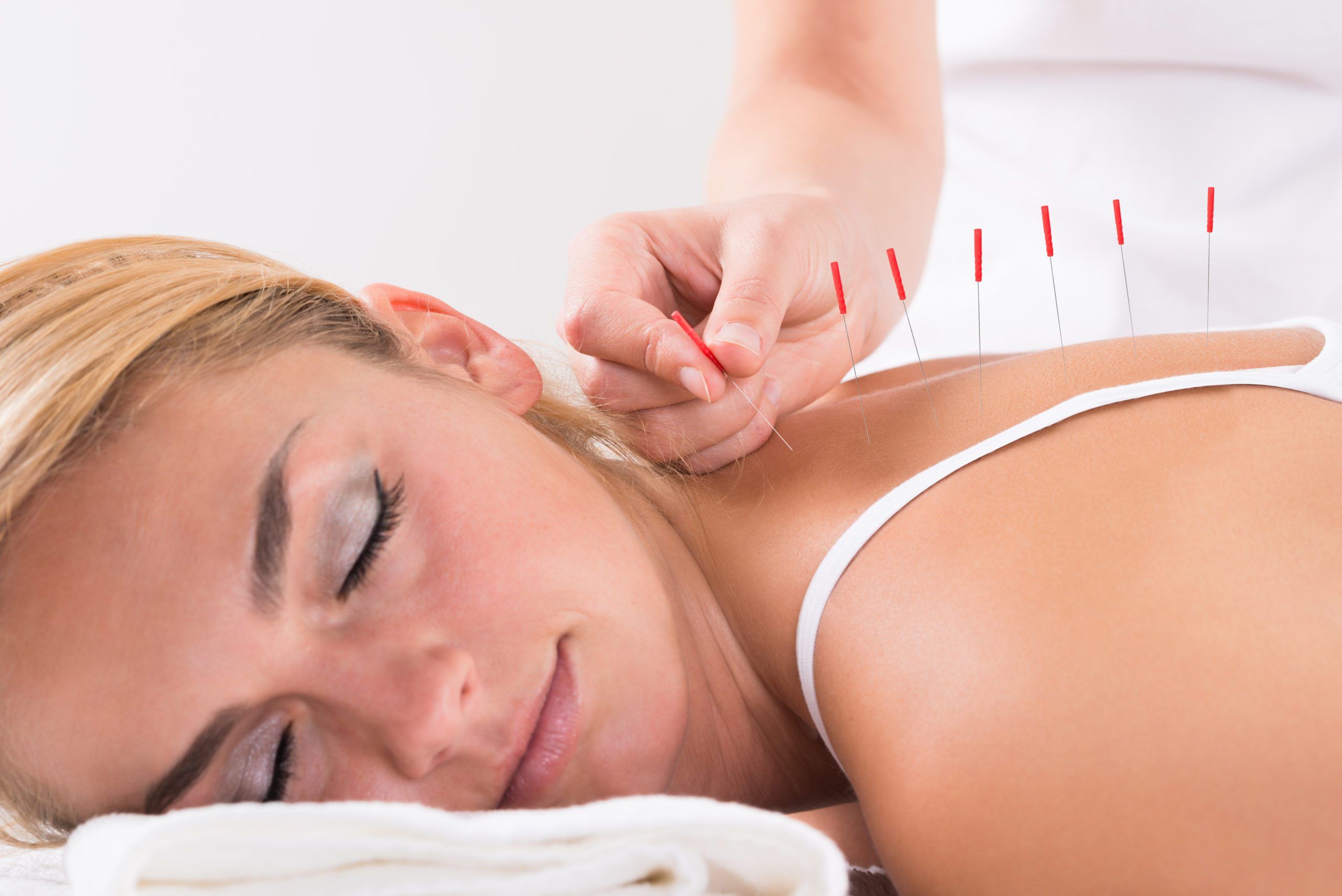 Everything You Need To Know About Acupuncture And What To Expect During An Acupuncture Treatment
