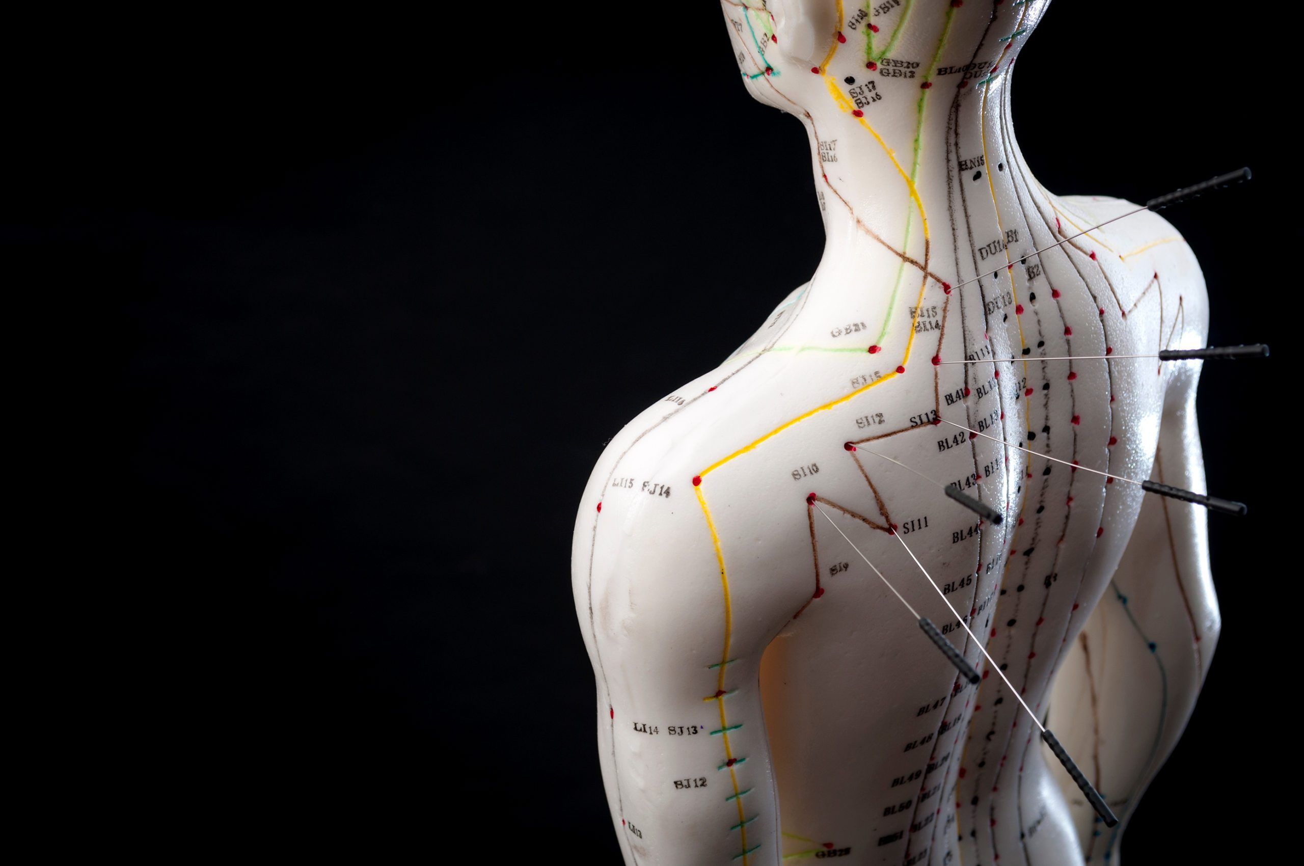 Acupuncture diagram