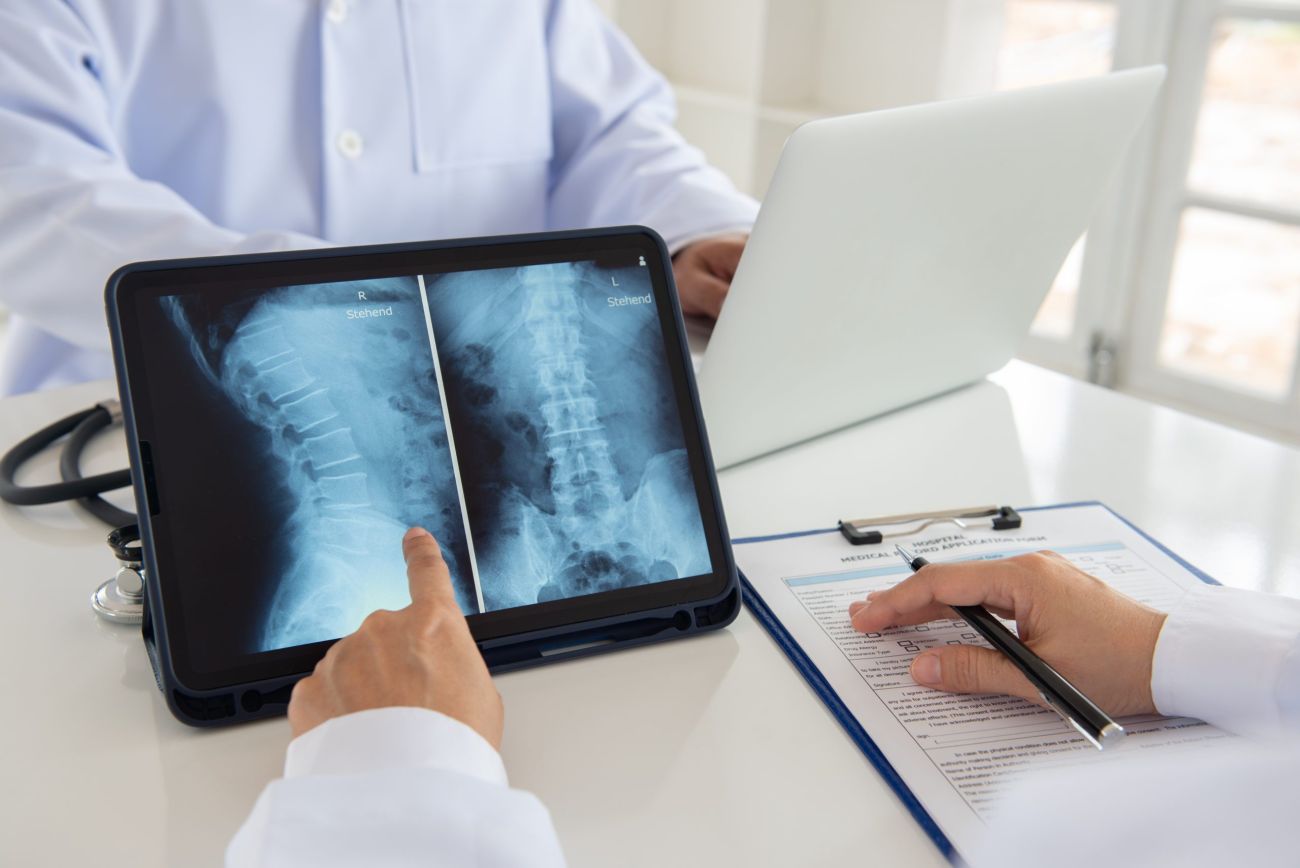 X-ray study